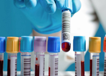 Загальний аналіз крові (ЗАК) в Одесі — професійна лабораторна діагностика в САЙНСЛАБ