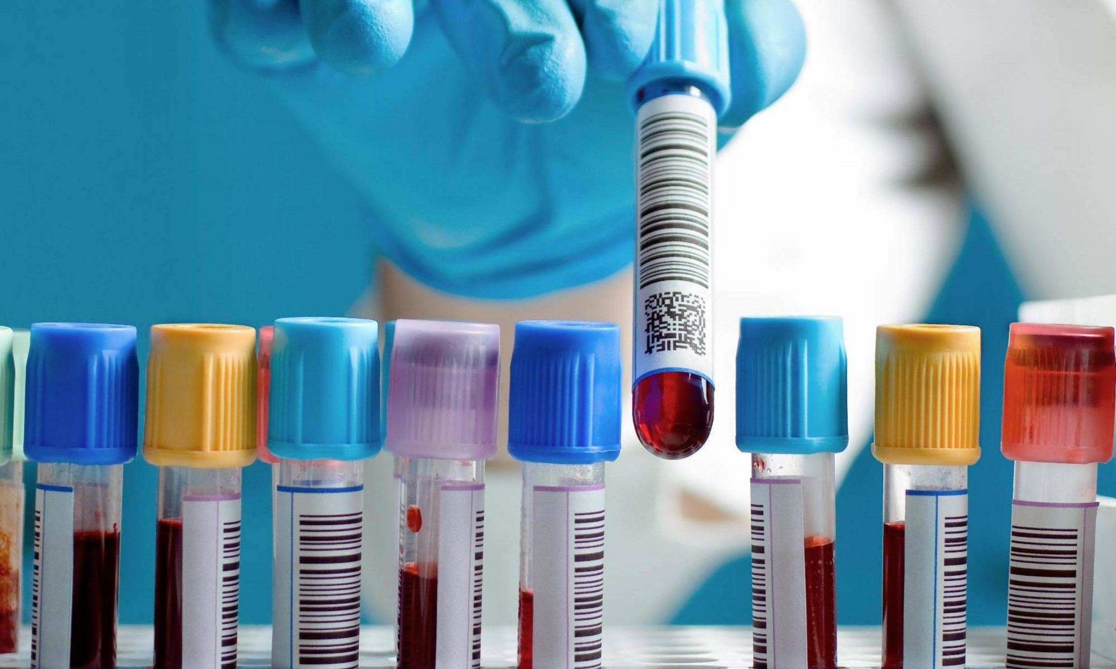 Загальний аналіз крові (ЗАК) в Одесі — професійна лабораторна діагностика в САЙНСЛАБ