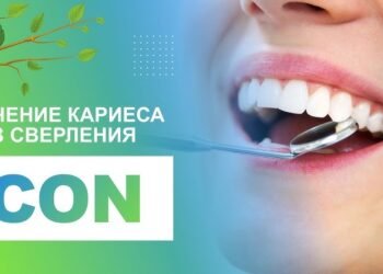 Лечение кариеса без препарирования — современный подход к здоровью зубов