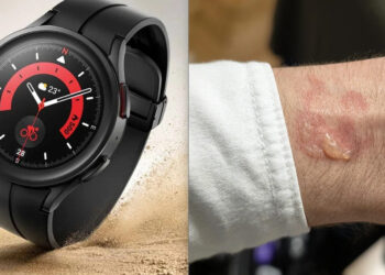 Samsung Galaxy Watch перегріваються та залишають опіки: що відомо